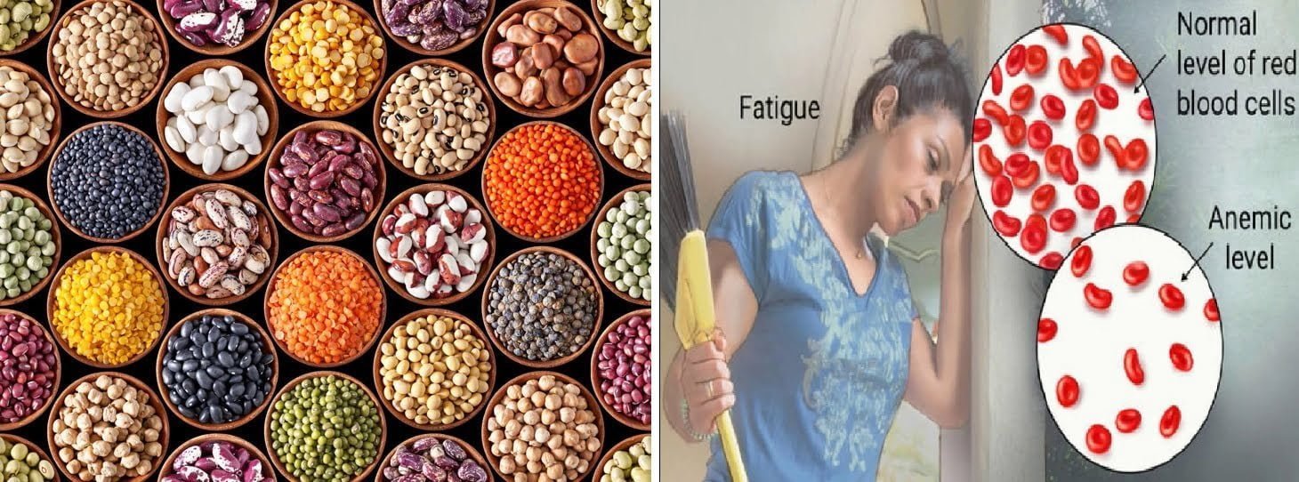 An Alarming Scenario: 61.74% of Girl Students Found Anemic in Anantapur District in AP