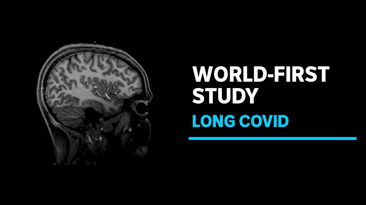 Long Covid and Chronic Fatigue Syndrome (ME/CFS) Explored in Depth