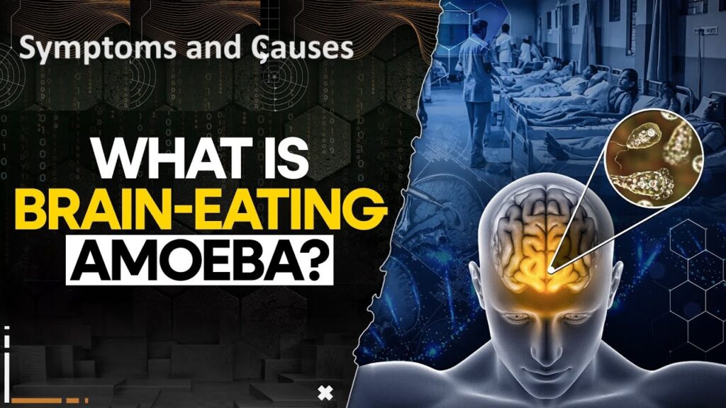 Deaths in Kerala Raise Alarm Over Brain-Eating Amoeba Threat The recent fatalities of three children in Kerala due to the brain-eating amoeba, Naegleria fowleri, have shocked the community and highlighted the urgent need for increased awareness and preventive measures. This article delves into understanding this deadly amoeba, its infection process, symptoms, and crucial prevention strategies. Understanding Naegleria fowleri: The Brain-Eating Amoeba Naegleria fowleri is a single-celled organism often depicted in educational materials as relatively benign, typically causing dysentery (amoebiasis) treatable with anti-parasitic drugs. However, under specific conditions, this amoeba becomes highly lethal. What is Naegleria fowleri? Naegleria fowleri is a thermophilic amoeba that thrives in warm freshwater environments, such as lakes, rivers, and poorly maintained swimming pools. It is notorious for causing primary amoebic meningoencephalitis (PAM), a brain infection with an alarming fatality rate. Infection and Transmission: How Does Naegleria fowleri Enter the Body? The amoeba enters the human body through the nasal passages, typically when individuals engage in water activities in infected waters. From the nose, Naegleria fowleri travels to the brain, where it causes severe inflammation and brain tissue destruction. Common Sources of Infection Warm Freshwater Bodies: Lakes, rivers, and hot springs are primary habitats. Tap Water: In rare instances, contaminated tap water can pose a risk, especially when used for nasal irrigation without proper sterilization. Swimming Pools: Inadequately chlorinated swimming pools can also be a source of infection. Symptoms and Diagnosis: Recognizing the Deadly Threat Primary amoebic meningoencephalitis (PAM) progresses rapidly, making early diagnosis critical. Symptoms of PAM High Fever and Severe Headache: Initial symptoms that can escalate quickly. Nausea and Vomiting: Accompanied by a stiff neck and sensitivity to light. Mental Confusion and Coma: Leading to death within days if untreated. Diagnostic Methods Healthcare providers use lumbar punctures to detect Naegleria fowleri in cerebrospinal fluid. Brain biopsies may also be performed to confirm the presence of the amoeba. Prevention: Steps to Avoid Naegleria fowleri Infection Given the high fatality rate, prevention is paramount. Safety Measures in Water Activities Nose Clips: Use nose clips when diving or swimming in warm freshwater. Avoid Stagnant Water: Refrain from swimming in warm, still waters known to harbor the amoeba. Safe Water Practices Sterilized Water for Nasal Irrigation: Use distilled or sterilized water for neti pots or nasal rinses. Boil tap water for at least one minute (three minutes at high altitudes) before use. Proper Pool Maintenance: Ensure swimming pools are adequately chlorinated and maintained. Treatment: Medical Interventions for Naegleria fowleri Infection Treatment options for PAM are limited and often not effective due to the rapid progression of the disease. Current Treatment Approaches Amphotericin B: An antifungal drug that has been used with limited success. Combination Therapy: Some survivors have been treated with a combination of drugs including amphotericin B, rifampin, fluconazole, and miltefosine. Importance of Early Diagnosis Early intervention with the right combination of drugs and supportive measures like therapeutic hypothermia (cooling the body) can improve survival chances, although outcomes remain generally poor. Conclusion: Vigilance and Prevention Are Key While the brain-eating amoeba, Naegleria fowleri, remains rare, its devastating impact underscores the need for vigilance and preventive measures. By understanding the risks and following safety guidelines, individuals can protect themselves from this deadly pathogen. Immediate medical attention at the first sign of symptoms following potential exposure is crucial for the best possible outcome. Stay informed, stay safe, and always prioritize water safety to mitigate the risks associated with Naegleria fowleri.