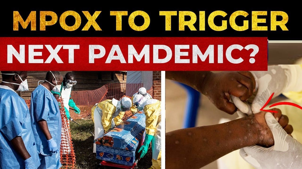 Exploring the Transmission of Mpox, Can It Spread Through the Air Like COVID-19